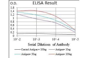 Black line: Control Antigen (100 ng), Purple line: Antigen(10 ng), Blue line: Antigen (50 ng), Red line: Antigen (100 ng), (Dynamin 1-Like antibody  (AA 69-213))