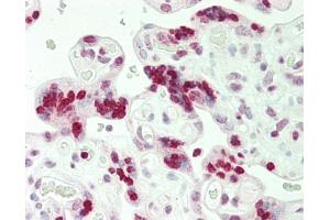 Human Placenta: Formalin-Fixed, Paraffin-Embedded (FFPE). (HIST1H1C antibody  (AA 101-150))