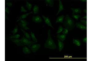 Image no. 3 for anti-Zic Family Member 4 (ZIC4) (AA 249-320) antibody (ABIN466251) (ZIC4 antibody  (AA 249-320))