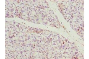 Immunohistochemistry of paraffin-embedded human pancreatic tissue using ABIN7148168 at dilution of 1:100 (CCDC89 antibody  (AA 1-200))