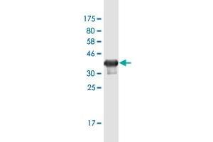 Western Blot detection against Immunogen (36. (DLGAP1 antibody  (AA 1-100))