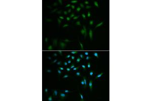 Immunofluorescence analysis of A549 cells using SUMO3 antibody (ABIN5971585). (SUMO3 antibody)