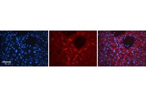 Rabbit Anti-TSTA3 Antibody  Catalog Number: ARP58679_P050 Formalin Fixed Paraffin Embedded Tissue: Human Adult Liver  Observed Staining: Cytoplasm in hepatocytes, strong signal, low tissue distribution Primary Antibody Concentration: 1:100 Secondary Antibody: Donkey anti-Rabbit-Cy3 Secondary Antibody Concentration: 1:200 Magnification: 20X Exposure Time: 0. (TSTA3 antibody  (N-Term))