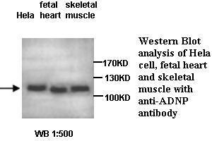 Image no. 1 for anti-Activity-Dependent Neuroprotector Homeobox (ADNP) antibody (ABIN1574495) (ADNP antibody)