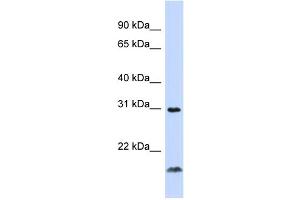 WB Suggested Anti-TNFSF14 Antibody Titration:  0. (TNFSF14 antibody  (Middle Region))