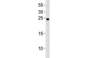 Western blot analysis of lysate from NCCIT cell line using LIN28A antibody at 1:1000. (LIN28A antibody  (N-Term))