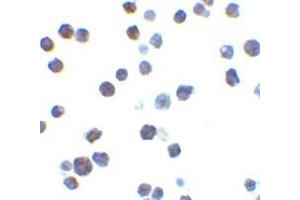 Immunocytochemistry of Bak in L1210 cells with AP30117PU-N Bak antibody at 2 μg/ml. (BAK1 antibody  (N-Term))