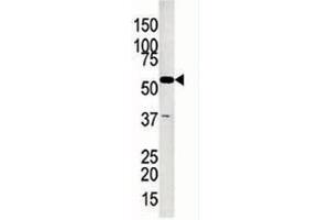 Glycerol kinase antibody used in western blot to detect GK2 in Jurkat lysate (GK2 antibody  (AA 487-515))