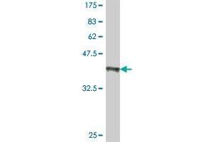 Western Blot detection against Immunogen (37. (ASCL1 antibody  (AA 137-236))