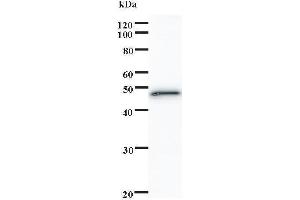 Western Blotting (WB) image for anti-SATB Homeobox 1 (SATB1) antibody (ABIN932488) (SATB1 antibody)