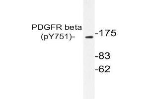 Western blot (WB) analysis of p-PDGFR beta antibody in extracts from NIH/3T3 PDGF cells . (PDGFRB antibody  (pTyr751))