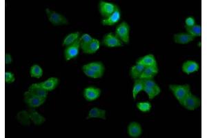 Immunofluorescence staining of HepG2 cells with ABIN7144968 at 1:166, counter-stained with DAPI. (RECQL4 antibody  (AA 200-337))
