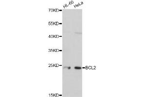 Western blot analysis of extracts of various cell lines, using BCL2 antibody. (Bcl-2 antibody)