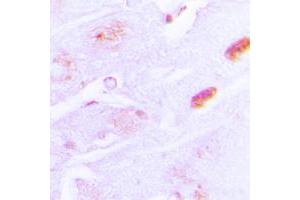 Immunohistochemical analysis of Amylin staining in human brain formalin fixed paraffin embedded tissue section. (Amylin/DAP antibody  (N-Term))