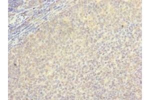 Immunohistochemistry of paraffin-embedded human tonsil tissue using ABIN7145628 at dilution of 1:100 (LOH12CR1 antibody  (AA 1-196))