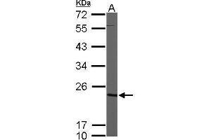 WB Image Sample (50 ug of whole cell lysate) A: Mouse brain 12% SDS PAGE antibody diluted at 1:1000 (Cytidine Monophosphate (UMP-CMP) Kinase 1, Cytosolic (CMPK1) (Center) antibody)