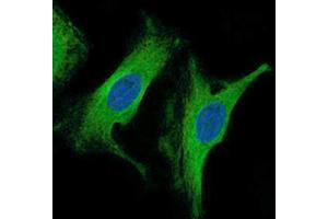 Immunofluorescence analysis of HeLa cells using β-tubulin antibody (green). (TUBB antibody)