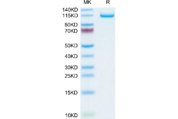 NRP2 Protein (AA 23-859) (His tag)