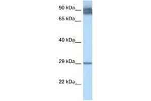 Image no. 1 for anti-Lecithin Retinol Acyltransferase (Phosphatidylcholine--Retinol O-Acyltransferase) (LRAT) (AA 51-100) antibody (ABIN6747475)