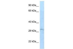 Western Blot showing TIPRL antibody used at a concentration of 1 ug/ml against 721_B Cell Lysate (TIPRL antibody  (N-Term))