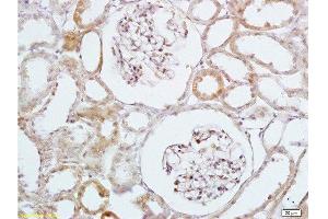 Formalin-fixed and paraffin embedded rat kidney labeled with Anti-HB EGF Polyclonal Antibody, Unconjugated  at 1:200 followed by conjugation to the secondary antibody and DAB staining (HBEGF antibody  (AA 51-150))
