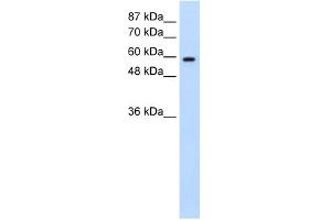 WB Suggested Anti-DAZ2 Antibody Titration:  0.