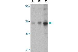 Western blot analysis of SOCS1 in human spleen tissue lysate with SOCS1 polyclonal antibody  at (A) 1, (B) 2 and (C) 4 ug/mL . (SOCS1 antibody  (N-Term))