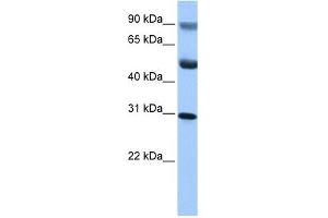 C17ORF39 antibody used at 1 ug/ml to detect target protein. (GID4 antibody  (C-Term))