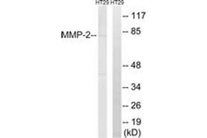 Western blot analysis of extracts from HT-29 cells, using MMP-2 Antibody. (MMP2 antibody  (AA 611-660))