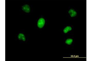 Immunofluorescence of purified MaxPab antibody to VRK1 on HeLa cell. (VRK1 antibody  (AA 1-396))