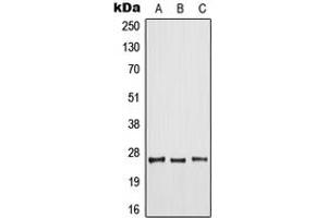 Western blot analysis of ARF6 expression in HeLa (A), mouse liver (B), rat spleen (C) whole cell lysates.
