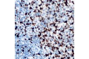 Immunohistochemical analysis of ANKRD1 staining in human lymph node formalin fixed paraffin embedded tissue section. (ANKRD1 antibody  (C-Term))
