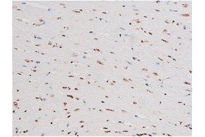 Immunohistochemistry (IHC) image for anti-Nuclear Factor-kB p65 (NFkBP65) (pThr435) antibody (ABIN6255688)