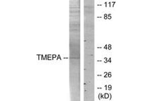 Western blot analysis of extracts from HT-29 cells, using TMEPA Antibody. (TMEPA (AA 101-150) antibody)