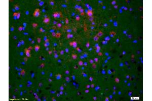 Formalin-fixed and paraffin-embedded rat brain labeled with Anti-Phospho-NMDAR2B (Tyr1252) Polyclonal Antibody, Unconjugated (ABIN801213) 1:200, overnight at 4°C, The secondary antibody was Goat Anti-Rabbit IgG, Cy3 conjugated used at 1:200 dilution for 40 minutes at 37°C. (GRIN2B antibody  (pTyr1252))