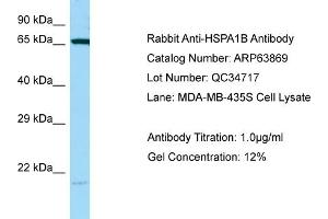 Western Blotting (WB) image for anti-Heat Shock 70kDa Protein 1B (HSPA1B) (C-Term) antibody (ABIN2789650) (HSPA1B antibody  (C-Term))