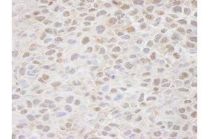 Immunohistochemistry (IHC) image for anti-CSE1 Chromosome Segregation 1-Like (CSE1L) (AA 1-50) antibody (ABIN7448490)
