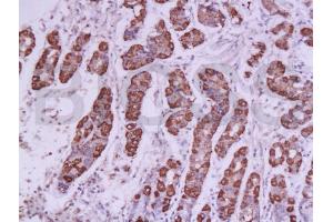 Formalin-fixed and paraffin embedded human stomach labeled with Anti-SOX2 Polyclonal Antibody, Unconjugated (ABIN669621) at 1:200 followed by conjugation to the secondary antibody and DAB staining (SOX2 antibody  (AA 227-317))