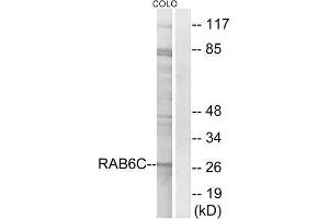 Western Blotting (WB) image for anti-RAB6C (WTH3DI) (Internal Region) antibody (ABIN1851986) (WTH3DI antibody  (Internal Region))