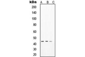 Western blot analysis of SOX17 expression in HeLa (A), LNCaP (B), DU145 (C) whole cell lysates. (SOX17 antibody  (Center))