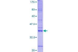 LRRFIP1 Protein (AA 1-105) (GST tag)