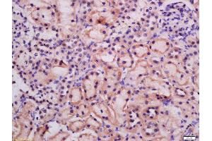 Formalin-fixed and paraffin embedded rat kidney labeled with Rabbit Anti-ATG9A Polyclonal Antibody, Unconjugated  at 1:200 followed by conjugation to the secondary antibody and DAB staining (ATG9A antibody  (AA 301-400))