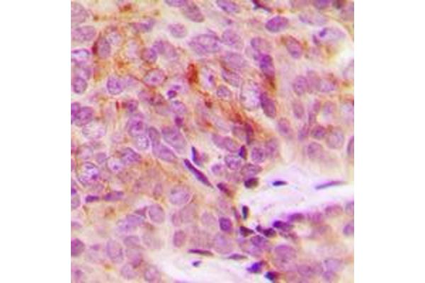 MRPS18A antibody  (Center)