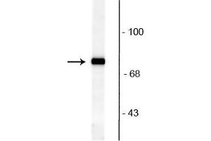 Western blot of rat brain lysate showing specific immunolabeling of the ~82 kDa rabphilin 3A phosphorylated at Ser234. (RPH3A antibody  (pSer234))