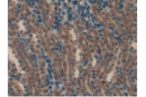 IHC-P analysis of Rat Kidney Tissue, with DAB staining. (aHSP antibody  (AA 2-102))