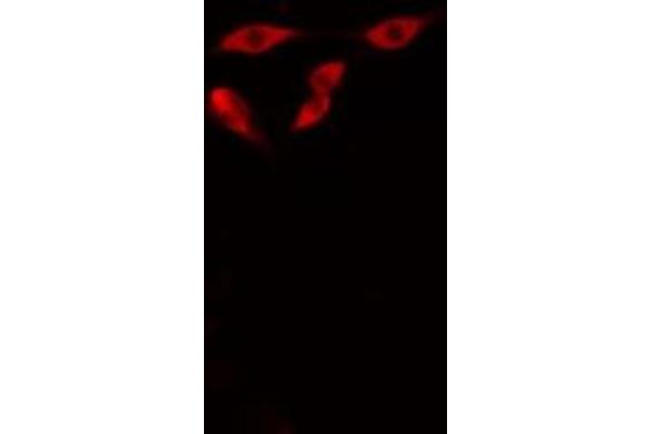 ELOVL6 antibody  (N-Term)