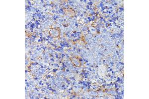 Immunohistochemistry of paraffin-embedded mouse spleen using SN antibody (ABIN7270670) at dilution of 1:100 (40x lens). (SNAP23 antibody  (AA 1-211))