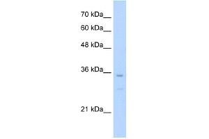 WB Suggested Anti-Bapx1 Antibody Titration:  0. (NKX3-2 antibody  (N-Term))