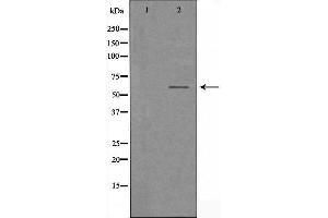 Western blot analysis of extracts from HUVEC cells, using TCF4/12 antibody. (TCF4/12 antibody)