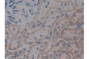 Detection of PXN in Rat Kidney Tissue using Polyclonal Antibody to Paxillin (PXN) (Paxillin antibody  (AA 327-568))